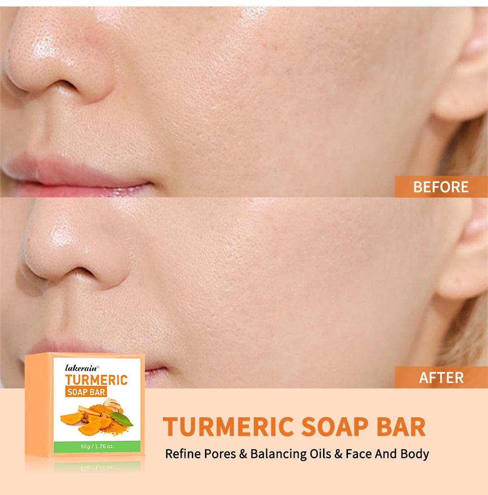 Turmeric Soap Bar