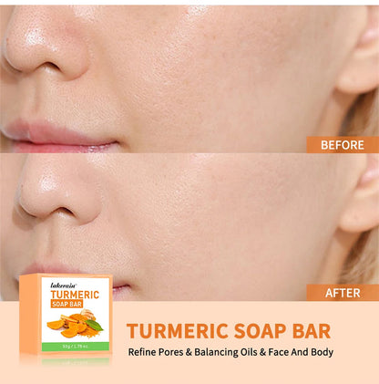 Turmeric Soap Bar